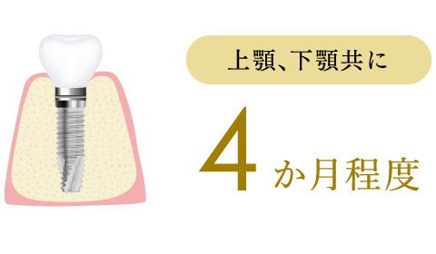 上顎、下顎共に4ヶ月程度