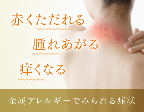金属アレルギーでみられる症状：赤くただれる、腫れあがる、痒くなる